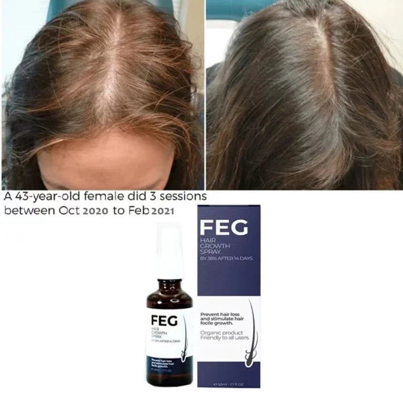 FEG Plus Hair Growth Spray - Haya By Rabi