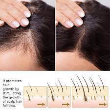 FEG Plus Hair Growth Spray - Haya By Rabi